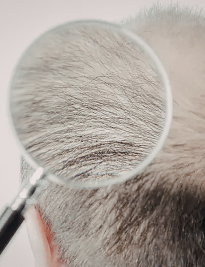 Scalp Microneedling