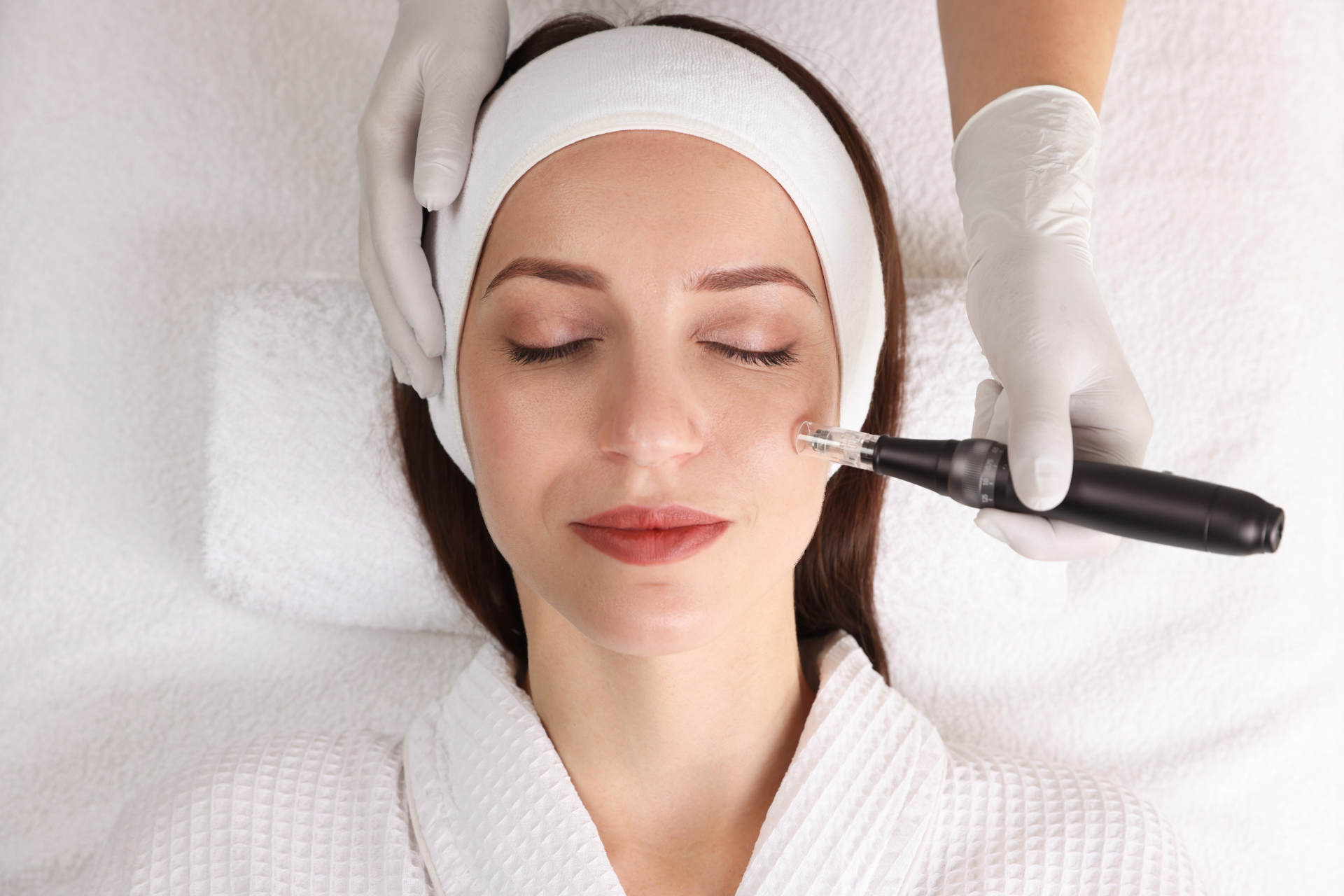 Microneedling