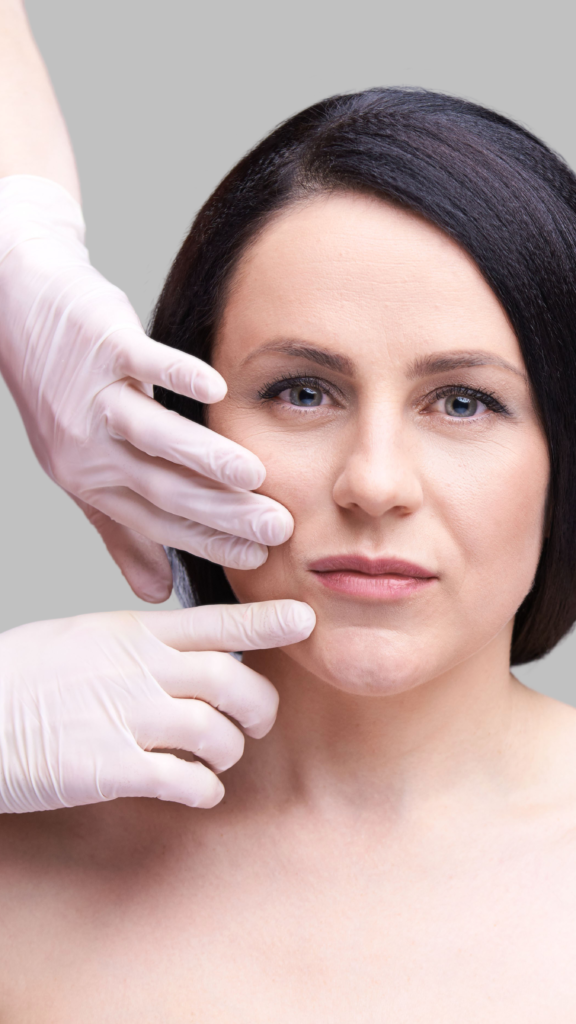 Consultation for Sculptra
